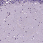 Immunohistochemical staining of human cerebellum shows strong positivity in nucleoli in Purkinje cells.