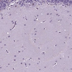 Immunohistochemical staining of human cerebellum shows strong positivity in nucleoli in Purkinje cells.