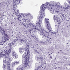 Immunohistochemical staining of human prostate shows no positivity in glandular cells.