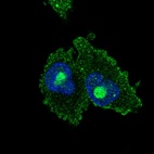 Immunofluorescent staining of human cell line SK-MEL-30 shows localization to nucleoli & plasma membrane.