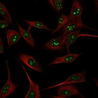 Immunofluorescent staining of human cell line SK-MEL-30 using Anti-C18orf21 antibody HPA065505, showing protein localization to nucleoli (green). Microtubule and nuclear probes are visualized in red and blue, respectively (where available).