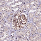 Immunohistochemical staining of human kidney shows moderate nuclear positivity in cells in glomeruli with additional cytoplasmic positivity.