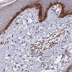 Immunohistochemical staining of human skin shows strong membranous-cytoplasmic positivity in squamous epithelial cells.