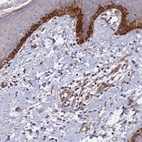 Immunohistochemical staining of human skin shows strong membranous-cytoplasmic positivity in squamous epithelial cells.