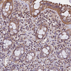 Immunohistochemical staining of human rectum shows moderate nuclear positivity in lymphoid cells with additional cytoplasmic positivity in glandular cells.