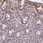 Immunohistochemical staining of human rectum shows moderate nuclear positivity in lymphoid cells with additional cytoplasmic positivity in glandular cells.