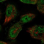 Immunofluorescent staining of human cell line U-251 MG shows localization to nucleoplasm & cytosol.