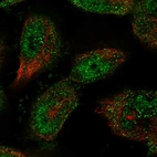 Immunofluorescent staining of human cell line U-251 MG shows localization to nucleoplasm & cytosol.