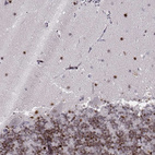 Immunohistochemical staining of human cerebellum shows strong nuclear positivity in molecular layer and granular layer.