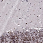 Immunohistochemical staining of human cerebellum shows strong nuclear positivity in molecular layer and granular layer.