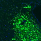 Immunohistochemical staining of rat locus coeruleus shows strong cytoplasmic immunoreactivity in monoaminergic neurons.