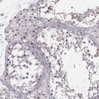 Immunohistochemical staining of human testis shows weak nuclear positivity in Leydig cells.