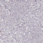 Immunohistochemical staining of human liver shows no positivity in hepatocytes.