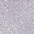 Immunohistochemical staining of human liver shows no positivity in hepatocytes.