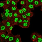 Immunofluorescent staining of human cell line RT-4 using Anti-MECOM antibody HPA046537, showing protein localization to nucleoplasm (green). Microtubule and nuclear probes are visualized in red and blue, respectively (where available).