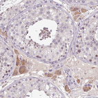 Immunohistochemical staining of human testis shows moderate cytoplasmic positivity in subset of Leydig cells.
