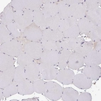 Immunohistochemical staining of human skeletal muscle shows no positivity in myocytes as expected.