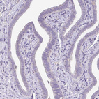 Immunohistochemical staining of human fallopian tube shows no positivity in glandular cells.