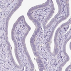 Immunohistochemical staining of human fallopian tube shows no positivity in glandular cells.