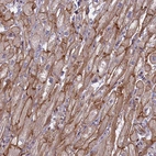 Immunohistochemical staining of human heart muscle shows strong membranous-cytoplasmic positivity in cardiomyocytes.