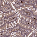 Immunohistochemical staining of human small intestine shows moderate membranous-cytoplasmic positivity in glandular cells.