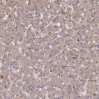 Immunohistochemical staining of human liver shows weak cytoplasmic positivity in hepatocytes.