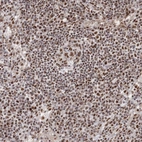 Immunohistochemical staining of human lymphoid node shows strong nuclear positivity in non-germinal center cells.