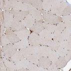 Immunohistochemical staining of human skeletal muscle shows strong nuclear positivity in myocytes.