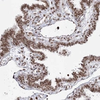 Immunohistochemical staining of human fallopian tube shows strong nuclear positivity in glandular cells.