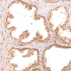 Immunohistochemical staining of human prostate shows moderate to strong nuclear positivity in glandular cells.
