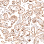 Immunohistochemical staining of human placenta shows strong nuclear positivity in stromal cells.