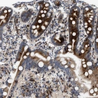Immunohistochemical staining of human duodenum shows strong cytoplasmic positivity in glandular cells.