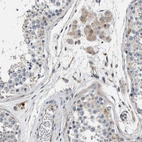 Immunohistochemical staining of human testis shows moderate cytoplasmic positivity in Leydig cells.