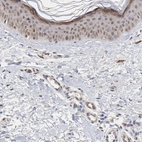Immunohistochemical staining of human skin shows moderate cytoplasmic/cytoplasmic granular positivity in squamous epithelial cells.