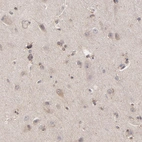 Immunohistochemical staining of human cerebral cortex shows weak cytoplasmic/cytoplasmic granular positivity in neuronal cells.