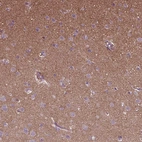 Immunohistochemical staining of human cerebral cortex shows moderate cytoplasmic positivity in neuropil.