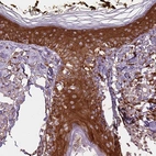 Immunohistochemical staining of human skin shows strong cytoplasmic positivity in squamous epithelial cells.