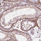 Immunohistochemical staining of human testis shows strong membranous positivity in peritubular myoid cells.
