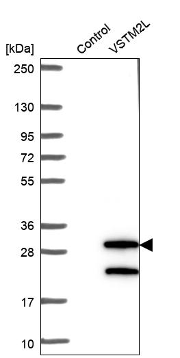 Anti-VSTM2L Antibody