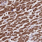 Immunohistochemical staining of human heart muscle shows strong cytoplasmic positivity in cardiomyocytes.