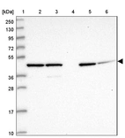 Lane 1: Marker [kDa] 250, 130, 95, 72, 55, 36, 28, 17, 10_br/_Lane 2: Human cell line RT-4_br/_Lane 3: Human cell line U-251MG sp_br/_Lane 4: Human plasma (IgG/HSA depleted)_br/_Lane 5: Human liver tissue_br/_Lane 6: Human tonsil tissue