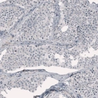Immunohistochemical staining of human testis shows no positivity in cells in seminiferous ducts as expected.