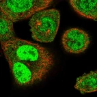 Immunofluorescent staining of human cell line A-431 shows localization to nucleoplasm & cytosol.