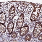 Immunohistochemical staining of human rectum shows moderate nuclear positivity in lymphoid cells and cytoplasmic positivity in glandular cells.