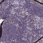 Immunohistochemical staining of human lymph node shows moderate nuclear positivity in subset of non-germinal center cells.