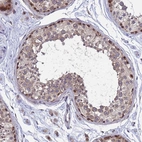 Immunohistochemical staining of human testis shows moderate nuclear positivity in subset of cells in seminiferous ducts with weak cytoplasmic positivity.