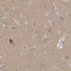 Immunohistochemical staining of human cerebral cortex shows moderate nuclear positivity in subset of neuronal cells and moderate cytoplasmic positivity in neuropil.