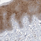 Immunohistochemical staining of human skin shows moderate nuclear positivity in squamous epithelial cells.