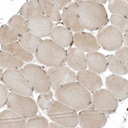 Immunohistochemical staining of human skeletal muscle shows moderate nuclear positivity in myocytes with moderate nucleus positivity.