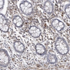 Immunohistochemical staining of human colon shows moderate cytoplasmic with additional nucleus positivity in lymphoid cells.